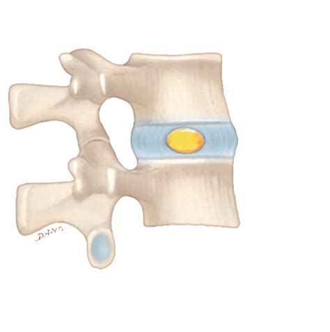 intervertebral disc mechanical test compression|intervertebral disc anatomy.